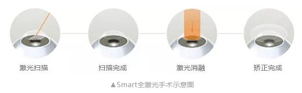 ȫ뼤Smartȫ뼤ֲ2.jpg