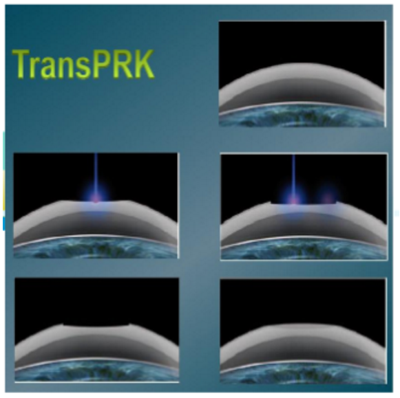 ޷ֹۿơаϣȾ3.png